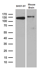 DBN1 / Drebrin Antibody - Western blot analysis of extracts. (35ug) from SHSY-5Y cell line and mouse brain tissue lysate by using anti-DBN1 monoclonal antibody. (1:500)