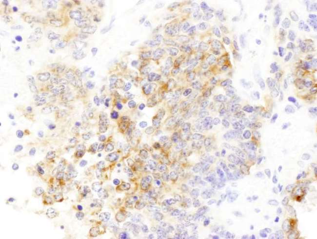 DBN1 / Drebrin Antibody - Detection of mouse Drebrin by immunohistochemistry. Sample: FFPE section of mouse teratoma. Antibody: Affinity purified rabbit anti- Drebrin used at a dilution of 1:1,000 (1µg/ml). Detection: DAB