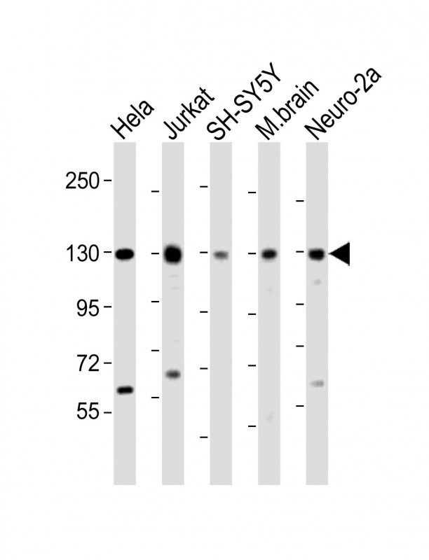 DBN1 / Drebrin Antibody - All lanes: Anti-DBN1 Antibody (Center) at 1:2000 dilution Lane 1: Hela whole cell lysate Lane 2: Jurkat whole cell lysate Lane 3: SH-SY5Y whole cell lysate Lane 4: mouse brain lysate Lane 5: Neuro-2a whole cell lysate Lysates/proteins at 20 µg per lane. Secondary Goat Anti-Rabbit IgG, (H+L), Peroxidase conjugated at 1/10000 dilution. Predicted band size: 71 kDa Blocking/Dilution buffer: 5% NFDM/TBST.