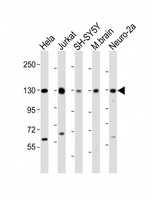 DBN1 / Drebrin Antibody - All lanes: Anti-DBN1 Antibody (Center) at 1:2000 dilution Lane 1: Hela whole cell lysate Lane 2: Jurkat whole cell lysate Lane 3: SH-SY5Y whole cell lysate Lane 4: mouse brain lysate Lane 5: Neuro-2a whole cell lysate Lysates/proteins at 20 µg per lane. Secondary Goat Anti-Rabbit IgG, (H+L), Peroxidase conjugated at 1/10000 dilution. Predicted band size: 71 kDa Blocking/Dilution buffer: 5% NFDM/TBST.