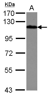 DBN1 / Drebrin Antibody - Sample (30 ug of whole cell lysate) A: IMR32 7.5% SDS PAGE DBN1 / Drebrin antibody diluted at 1:10000