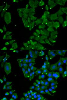 DBN1 / Drebrin Antibody - Immunofluorescence analysis of HeLa cells using DBN1 Polyclonal Antibody.