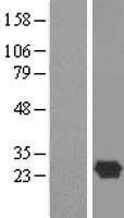 DBNDD1 Protein - Western validation with an anti-DDK antibody * L: Control HEK293 lysate R: Over-expression lysate