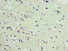 DBNDD2 Antibody - Immunohistochemistry of paraffin-embedded human brain tissue using antibody at 1:100 dilution.  This image was taken for the unconjugated form of this product. Other forms have not been tested.