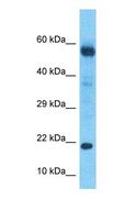 DBNDD2 Antibody - Western blot of DBNDD2 Antibody with human Gallbladder Tumor lysate.  This image was taken for the unconjugated form of this product. Other forms have not been tested.