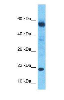 DBNDD2 Antibody - Western blot of DBNDD2 Antibody with human Gallbladder Tumor lysate.  This image was taken for the unconjugated form of this product. Other forms have not been tested.