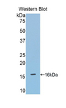 DBR1 Antibody - Western blot of recombinant DBR1.  This image was taken for the unconjugated form of this product. Other forms have not been tested.