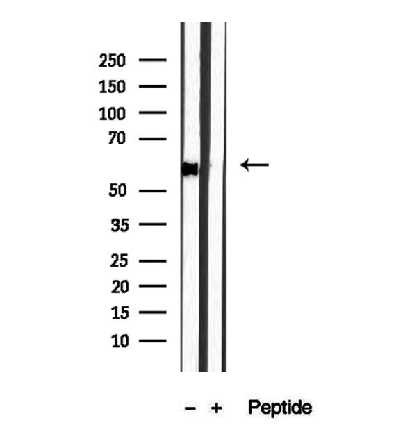 DBR1 Antibody - Western blot analysis of extracts of HepG2 cells using DBR1 antibody.