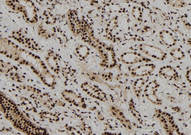 DBR1 Antibody - 1:100 staining human kidney tissue by IHC-P. The sample was formaldehyde fixed and a heat mediated antigen retrieval step in citrate buffer was performed. The sample was then blocked and incubated with the antibody for 1.5 hours at 22°C. An HRP conjugated goat anti-rabbit antibody was used as the secondary.