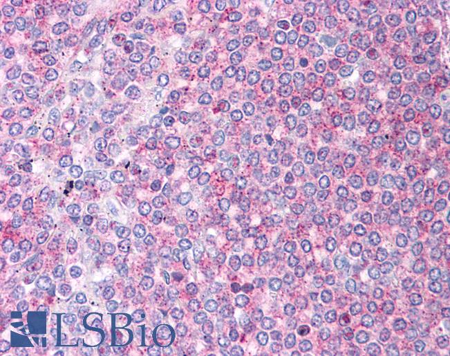 DBT / E2 Antibody - Anti-DBT / E2 antibody IHC of human spleen. Immunohistochemistry of formalin-fixed, paraffin-embedded tissue after heat-induced antigen retrieval. Antibody concentration 5 ug/ml.  This image was taken for the unconjugated form of this product. Other forms have not been tested.