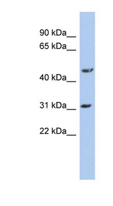 DBT / E2 Antibody - DBT / E2 antibody Western blot of HT1080 cell lysate. This image was taken for the unconjugated form of this product. Other forms have not been tested.