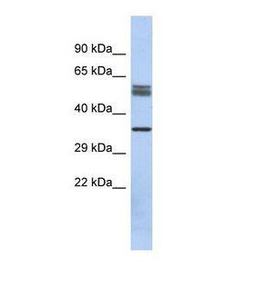 DBT / E2 Antibody - Western blot of Human Fetal Kidney. DBT antibody dilution 1.0 ug/ml.  This image was taken for the unconjugated form of this product. Other forms have not been tested.