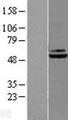 DBT / E2 Protein - Western validation with an anti-DDK antibody * L: Control HEK293 lysate R: Over-expression lysate