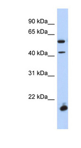 DBX1 Antibody - DBX1 antibody Western blot of Fetal Spleen lysate. This image was taken for the unconjugated form of this product. Other forms have not been tested.