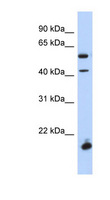 DBX1 Antibody - DBX1 antibody Western blot of Fetal Spleen lysate. This image was taken for the unconjugated form of this product. Other forms have not been tested.
