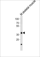 DBX1 Antibody - Western blot of lysate from mouse skeletal muscle tissue with Dbx1 Antibody. Antibody was diluted at 1:1000. A goat anti-rabbit IgG H&L (HRP) at 1:10000 dilution was used as the secondary antibody. Lysate at 20 ug.