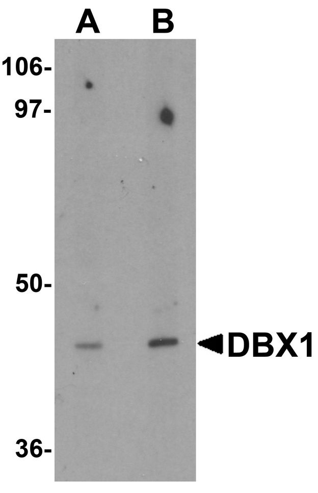 DBX1 Antibody - Western blot analysis of DBX1 in mouse kidney tissue lysate with DBX1 antibody at (A) 1 and (B) 2 ug/ml.