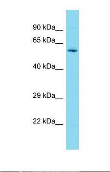 DCAF10 Antibody - Western blot of Human HepG2. DCAF10 antibody dilution 1.0 ug/ml.  This image was taken for the unconjugated form of this product. Other forms have not been tested.