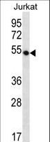 DCAF12 / WDR40A Antibody - WDR40A Antibody western blot of Jurkat cell line lysates (35 ug/lane). The WDR40A antibody detected the WDR40A protein (arrow).
