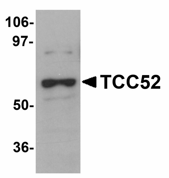 DCAF12 / WDR40A Antibody - Western blot of TCC52 in 293 cell lysate with TCC52 antibody at 1 ug/ml.