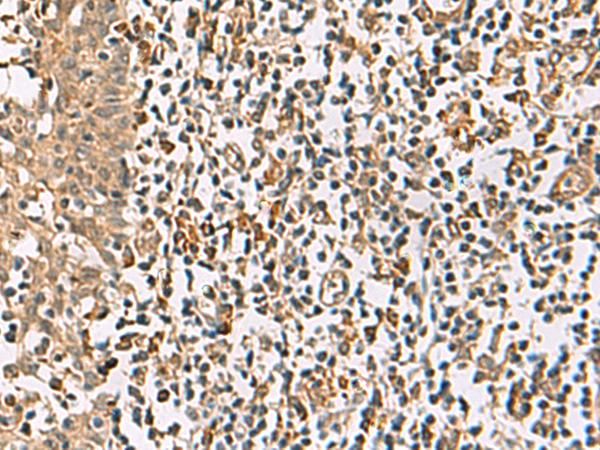 DCAF12 / WDR40A Antibody - Immunohistochemistry of paraffin-embedded Human tonsil tissue  using DCAF12 Polyclonal Antibody at dilution of 1:65(×200)
