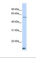 DCAF12 / WDR40A Antibody - Jurkat cell lysate. Antibody concentration: 1.0 ug/ml. Gel concentration: 12%.  This image was taken for the unconjugated form of this product. Other forms have not been tested.