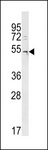 DCAF12L2 Antibody - DCAF12L2 Antibody western blot of A2058 cell line lysates (35 ug/lane). The DCAF12L2 antibody detected the DCAF12L2 protein (arrow).