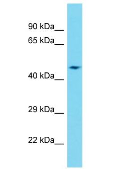 DCAF12L2 Antibody - DCAF12L2 antibody Western Blot of Fetal Heart. Antibody dilution: 1 ug/ml.  This image was taken for the unconjugated form of this product. Other forms have not been tested.
