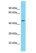 DCAF12L2 Antibody - DCAF12L2 antibody Western Blot of Fetal Heart. Antibody dilution: 1 ug/ml.  This image was taken for the unconjugated form of this product. Other forms have not been tested.