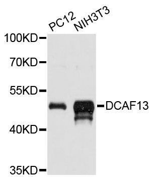 DCAF13 / WDSOF1 Antibody - Western blot analysis of extracts of various cell lines, using DCAF13 antibody at 1:3000 dilution. The secondary antibody used was an HRP Goat Anti-Rabbit IgG (H+L) at 1:10000 dilution. Lysates were loaded 25ug per lane and 3% nonfat dry milk in TBST was used for blocking. An ECL Kit was used for detection and the exposure time was 15s.