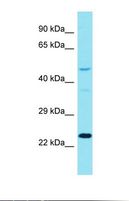 DCAF17 / C2orf37 Antibody - Western blot of PANC1 Whole Cell. DUS3L antibody dilution 1.0 ug/ml.  This image was taken for the unconjugated form of this product. Other forms have not been tested.