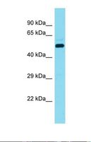 DCAF17 / C2orf37 Antibody - Western blot of Human 721_B. DCAF17 antibody dilution 1.0 ug/ml.  This image was taken for the unconjugated form of this product. Other forms have not been tested.