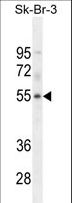 DCAF4L1 Antibody - WDR21B Antibody western blot of SK-BR-3 cell line lysates (35 ug/lane). The WDR21B antibody detected the WDR21B protein (arrow).