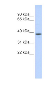 DCAF4L1 Antibody - DCAF4L1 / WDR21B antibody Western blot of Placenta lysate. This image was taken for the unconjugated form of this product. Other forms have not been tested.