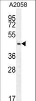 DCAF4L2 Antibody - WDR21C Antibody western blot of A2058 cell line lysates (35 ug/lane). The WDR21C antibody detected the WDR21C protein (arrow).