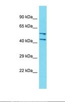 DCAF4L2 Antibody - Western blot of Human Fetal Kidney. DCAF4L2 antibody dilution 1.0 ug/ml.  This image was taken for the unconjugated form of this product. Other forms have not been tested.