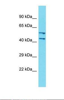 DCAF4L2 Antibody - Western blot of Human Fetal Kidney. DCAF4L2 antibody dilution 1.0 ug/ml.  This image was taken for the unconjugated form of this product. Other forms have not been tested.