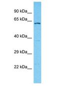 DCAF6 / NRIP Antibody - DCAF6 / NRIP antibody Western Blot of OVCAR-3. Antibody dilution: 1 ug/ml.  This image was taken for the unconjugated form of this product. Other forms have not been tested.