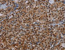 DCAF6 / NRIP Antibody - Immunohistochemistry of paraffin-embedded Human brain using DCAF6 Polyclonal Antibody at dilution of 1:30.