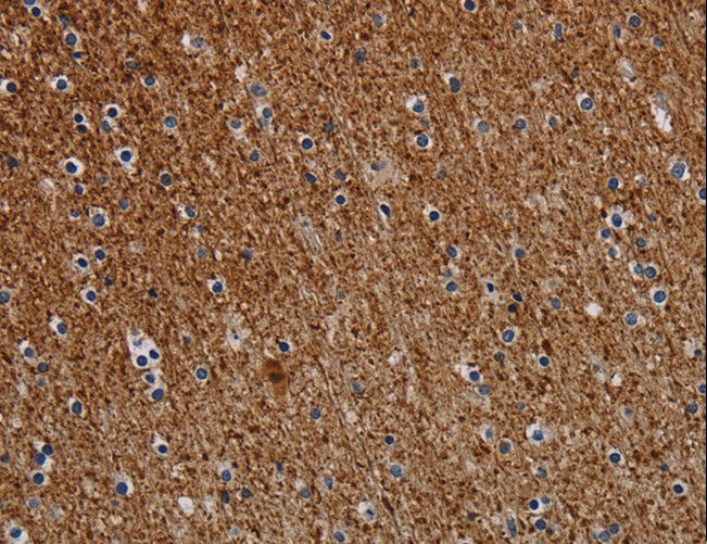 DCAF6 / NRIP Antibody - Immunohistochemistry of paraffin-embedded Human brain using DCAF6 Polyclonal Antibody at dilution of 1:30.