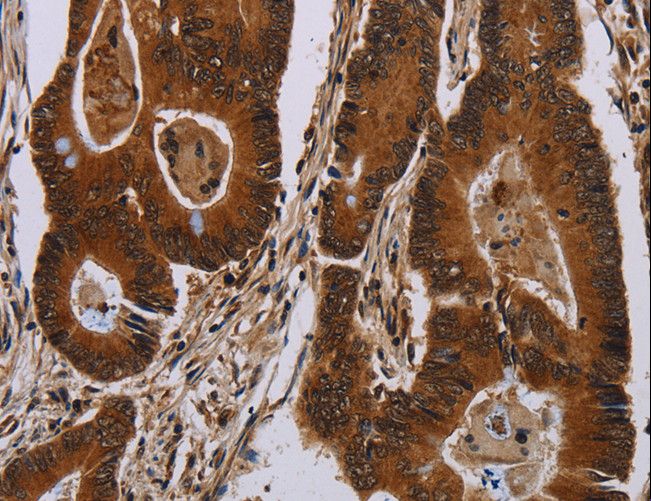 DCAF6 / NRIP Antibody - Immunohistochemistry of paraffin-embedded Human brain using DCAF6 Polyclonal Antibody at dilution of 1:50.