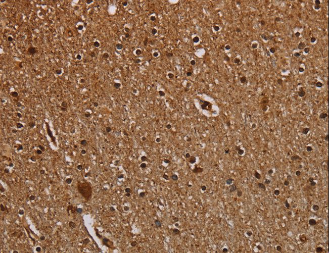 DCAF6 / NRIP Antibody - Immunohistochemistry of paraffin-embedded Human brain using DCAF6 Polyclonal Antibody at dilution of 1:50.