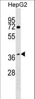 DCAF7 / WDR68 Antibody - WDR68 Antibody western blot of HepG2 cell line lysates (35 ug/lane). The WDR68 antibody detected the WDR68 protein (arrow).