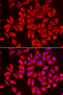 DCAF7 / WDR68 Antibody - Immunofluorescence analysis of U2OS cells.