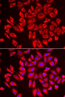 DCAF7 / WDR68 Antibody - Immunofluorescence analysis of U2OS cells.
