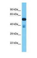 DCAF7 / WDR68 Antibody - Western blot of DCAF7 Antibody with human Gallbladder Tumor lysate.  This image was taken for the unconjugated form of this product. Other forms have not been tested.