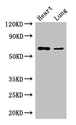 DCAF8 / WDR42A Antibody - Western Blot Positive WB detected in:Mouse heart tissue,Mouse lung tissue All Lanes: DCAF8 antibody at 3.5ug/ml Secondary Goat polyclonal to rabbit IgG at 1/50000 dilution Predicted band size: 67,31 kDa Observed band size: 67 kDa