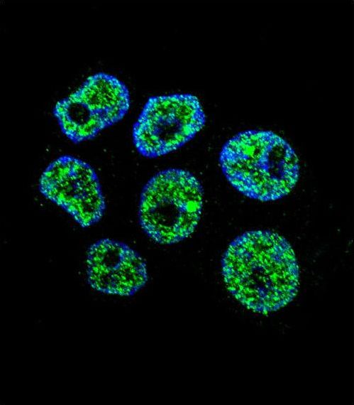 DCAF8L2 Antibody - Confocal immunofluorescence of WDR42C Antibody with ZR-75-1 cell followed by Alexa Fluor 488-conjugated goat anti-rabbit lgG (green). DAPI was used to stain the cell nuclear (blue).