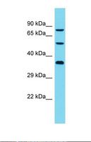 DCAF8L2 Antibody - Western blot of Human Jurkat. DCAF8L2 antibody dilution 1.0 ug/ml.  This image was taken for the unconjugated form of this product. Other forms have not been tested.