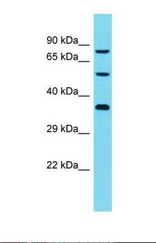 DCAF8L2 Antibody - Western blot of Human Jurkat. DCAF8L2 antibody dilution 1.0 ug/ml.  This image was taken for the unconjugated form of this product. Other forms have not been tested.